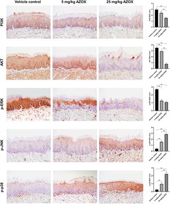 Azoxystrobin induces apoptosis via PI3K/AKT and MAPK signal pathways in oral leukoplakia progression